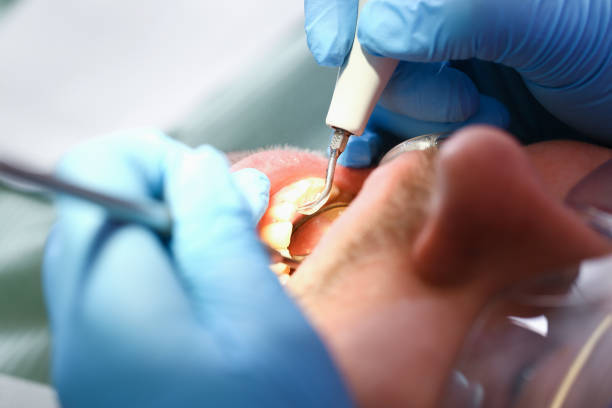 Best Emergency Denture Repair in Atkins, VA