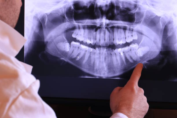 Best Emergency Care for Gum Disease in Atkins, VA
